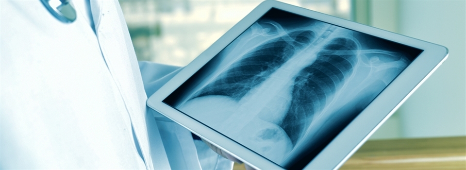 Mobile On-Site Chest X-ray Service